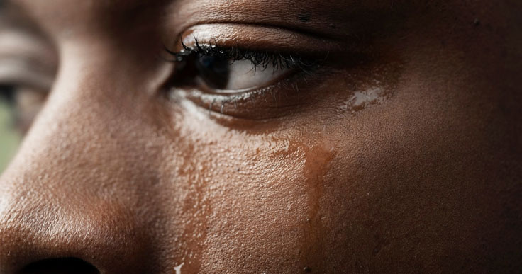  Desobstrução de Vias Lacrimais