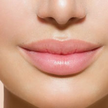 Preenchimento de Ácido Hialurônico