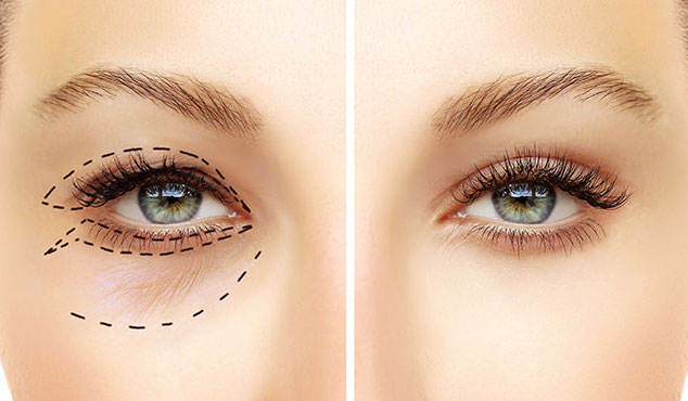 Orientações Pré-operatórias 