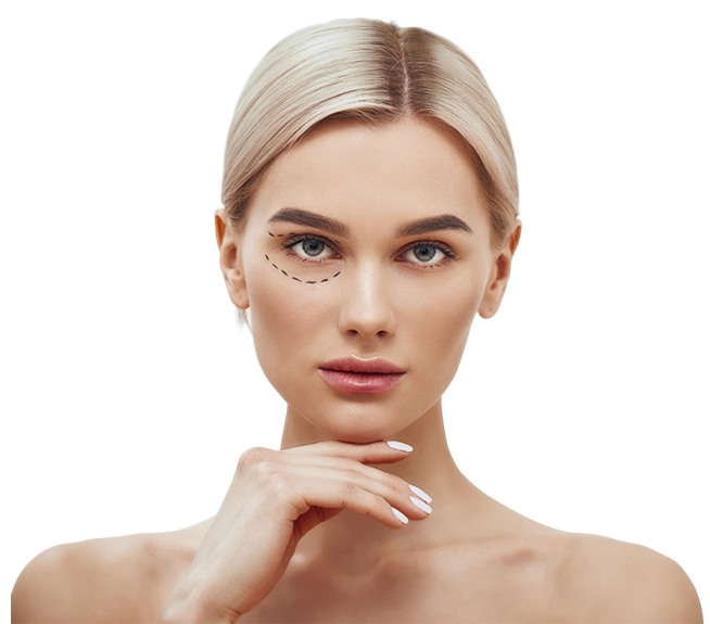 Blefaroplastia a Laser CO2